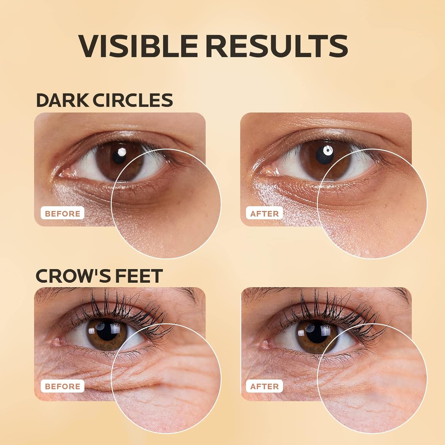 image:imageZealSea Caffeine Eye Cream 4in1 Anti Aging eye serum treatment for Dark CirclesPuffiness under eye Bags and Wrinkles Brightening Eye cream reduce Fine Lines 07 OZ