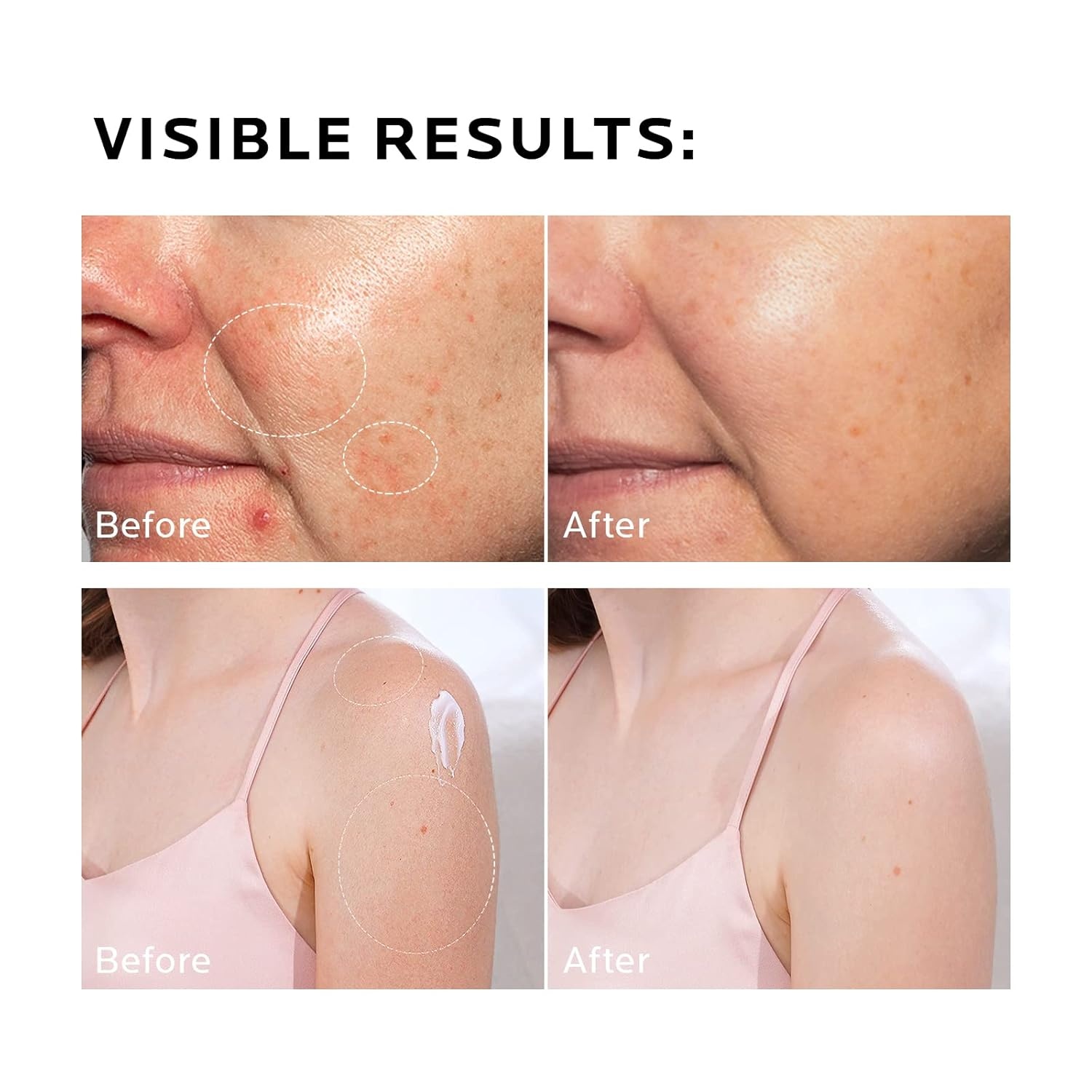image:imageZealSea Face Moisturiser Lotion with Hyaluronic Acid amp Ceramide amp Aloe Vera Hydration Moisturiser for Normal To Dry Sensitive Skin Facial and Body Hydrating Moisturizing Cream 290 ml