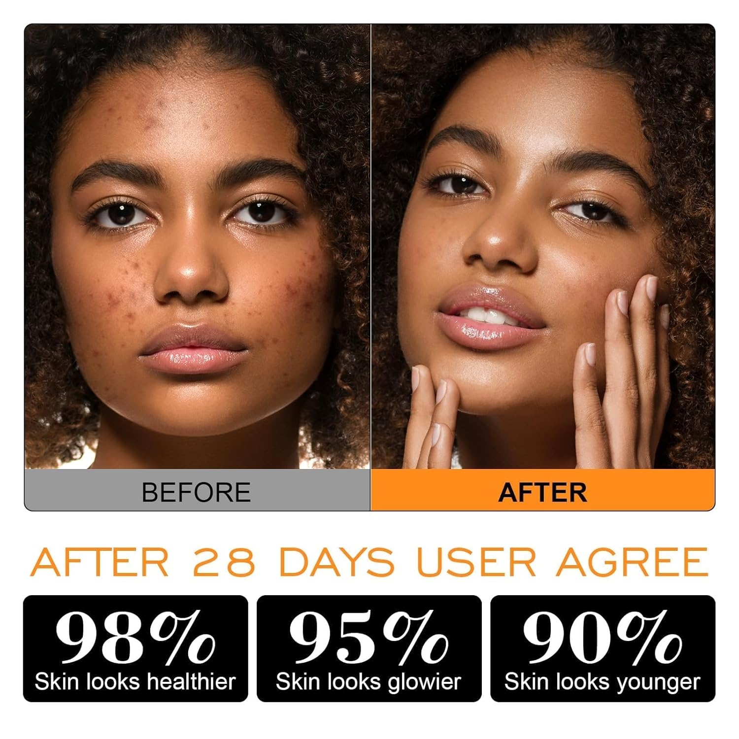 image:imageZealSea Vitamin C American Kaolin Clay Mask with Turmeric Pro UltraFine Creamy Texture Deep Pore Cleansing Even Skin Tone Brighten Control Oil Detoxify 30 Aloe Jojoba Oil Shea Butter amp SqualaneTurmeric 423 OZ Pack of 1